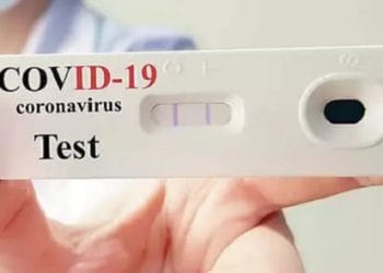 कर्मचाऱ्यांसाठी आरटीपीसीआर चाचणी बरोबर ॲन्टीजन चाचणीचा पर्याय