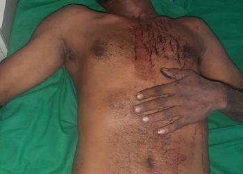 भंगार माफियांकडून स्थानिक तरुणाला बेदम मारहाण