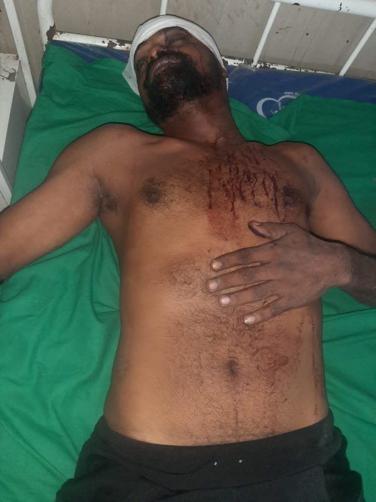 भंगार माफियांकडून स्थानिक तरुणाला बेदम मारहाण