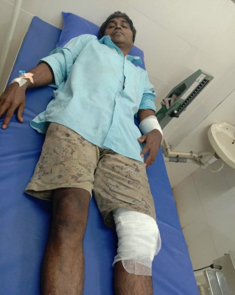 बेदम मारहाण करून आगीत ढकलले